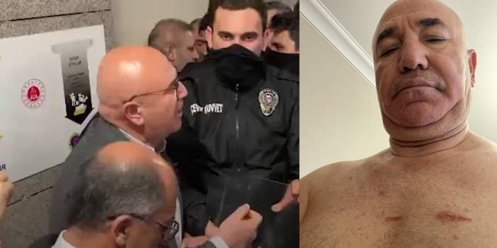 Mahmut Tanal: ‘Darp izlerini, çizikleri, morlukları gördüm’