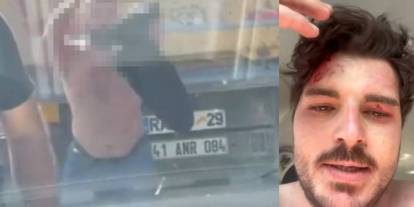 Ünlü oyuncuya trafikte saldırıya uğradı!