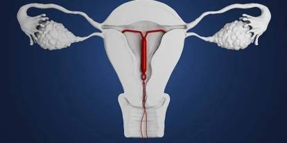 Danimarka, rızası olmadan spiral takılan 4 bin 500 kadına tazminat ödeyecek