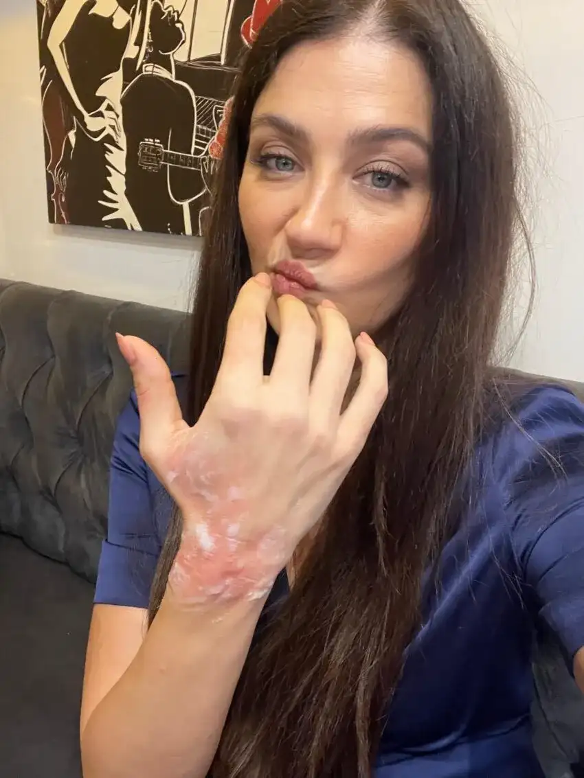 esref-ruyada-mikrodalga-kazasi-unlu-oyuncunun-eli-yandi-2