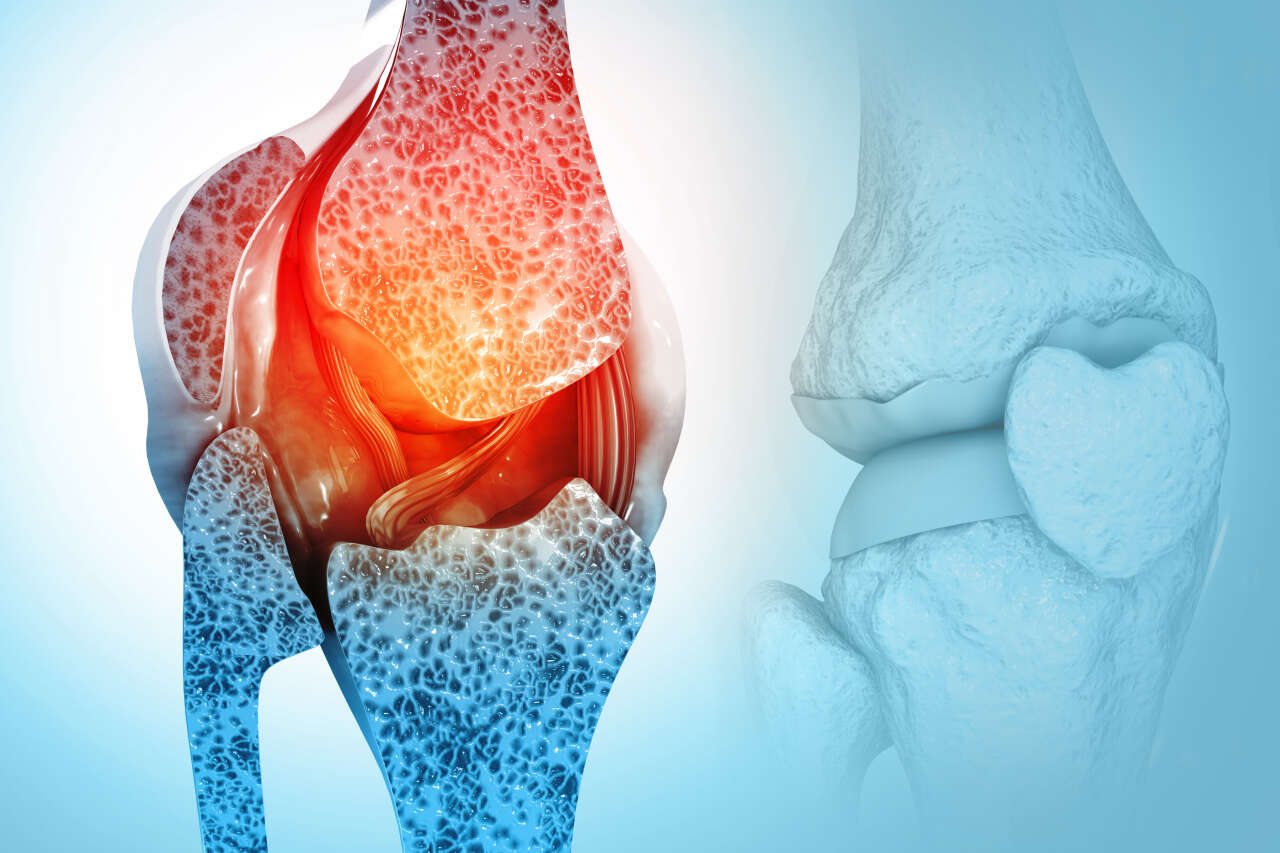 1773131984-kemik-erimesi1