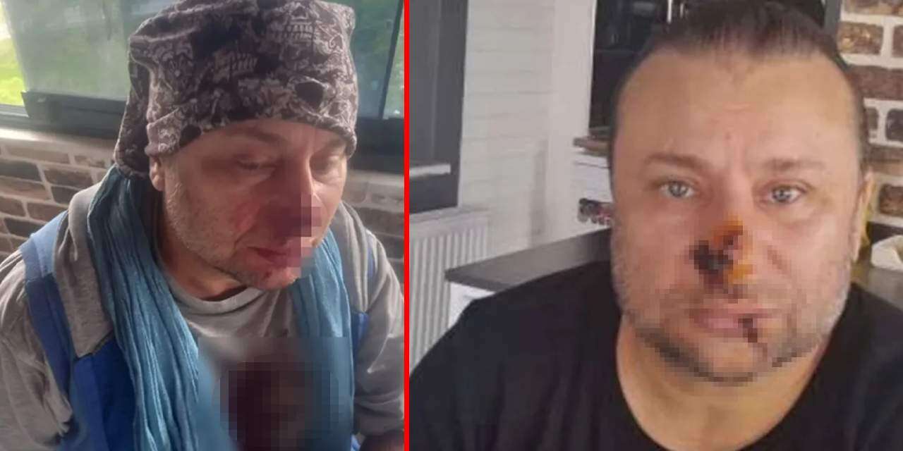 unlu-sarkicinin-yuzu-curumeye-basladi-entube-edildi-3