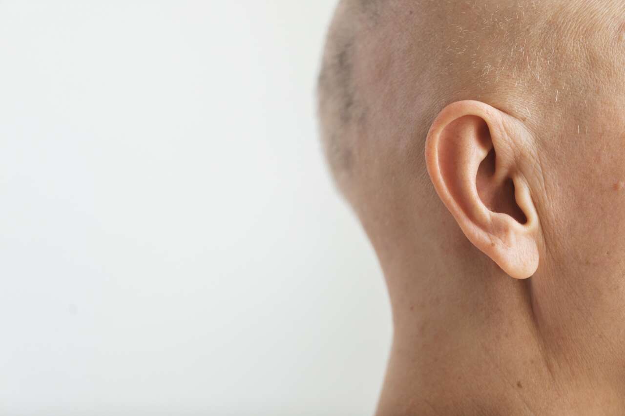 1788241289-woman-with-skin-cancer-with-copy-space